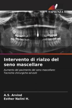 Intervento di rialzo del seno mascellare