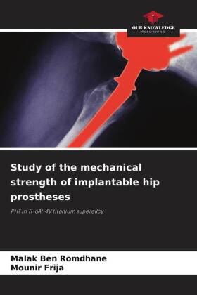 Study of the mechanical strength of implantable hip prostheses