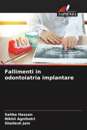 Fallimenti in odontoiatria implantare