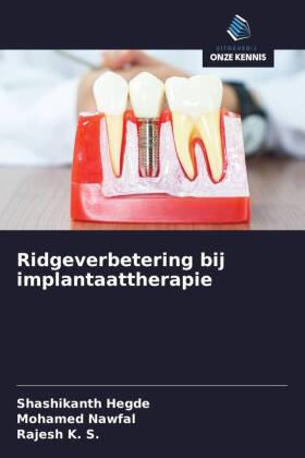 Ridgeverbetering bij implantaattherapie