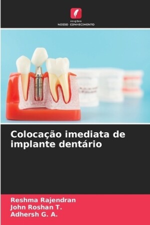 Colocação imediata de implante dentário