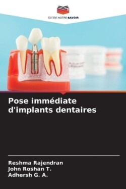 Pose immédiate d'implants dentaires