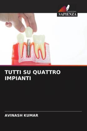 TUTTI SU QUATTRO IMPIANTI