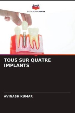 TOUS SUR QUATRE IMPLANTS