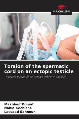 Torsion of the spermatic cord on an ectopic testicle