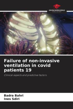 Failure of non-invasive ventilation in covid patients 19