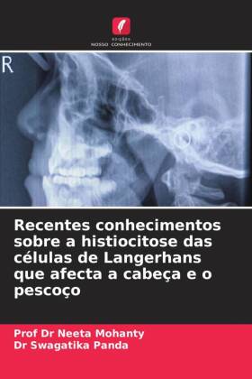 Recentes conhecimentos sobre a histiocitose das células de Langerhans que afecta a cabeça e o pescoço