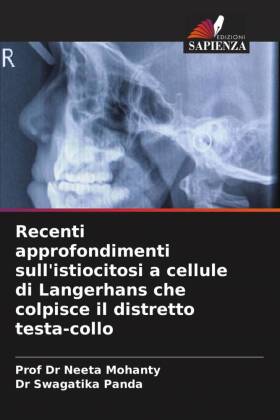 Recenti approfondimenti sull'istiocitosi a cellule di Langerhans che colpisce il distretto testa-collo