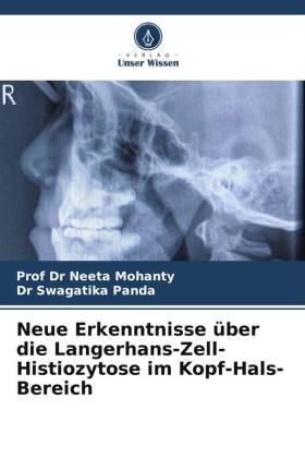 Neue Erkenntnisse über die Langerhans-Zell-Histiozytose im Kopf-Hals-Bereich