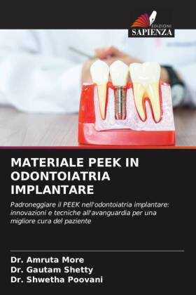 MATERIALE PEEK IN ODONTOIATRIA IMPLANTARE