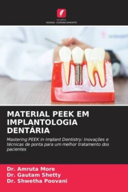 MATERIAL PEEK EM IMPLANTOLOGIA DENTÁRIA