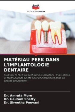 MATÉRIAU PEEK DANS L'IMPLANTOLOGIE DENTAIRE