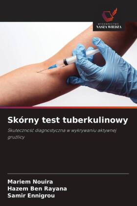 Skórny test tuberkulinowy