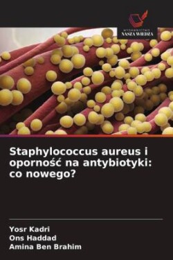 Staphylococcus aureus i opornosc na antybiotyki: co nowego?