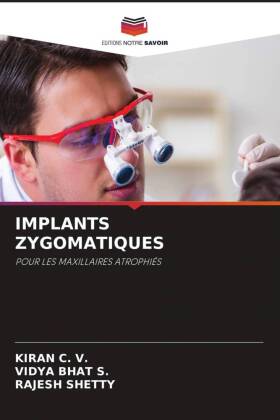 Implants Zygomatiques