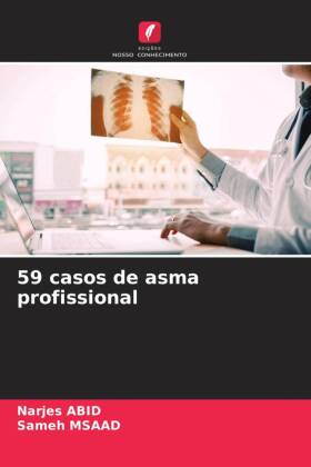 59 casos de asma profissional