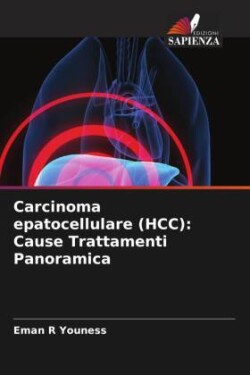 Carcinoma epatocellulare (HCC)