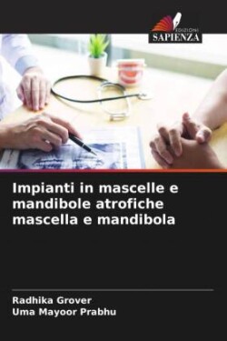 Impianti in mascelle e mandibole atrofiche mascella e mandibola