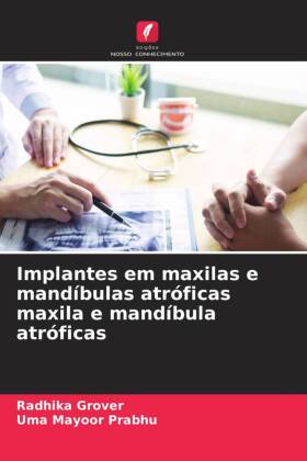 Implantes em maxilas e mandíbulas atróficas maxila e mandíbula atróficas