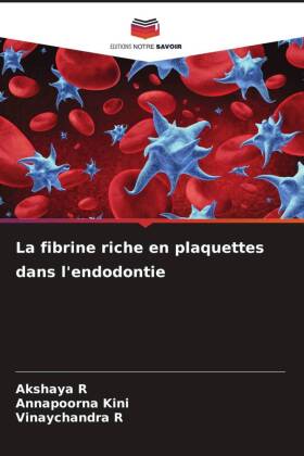 La fibrine riche en plaquettes dans l'endodontie