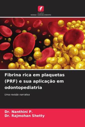 Fibrina rica em plaquetas (PRF) e sua aplicação em odontopediatria