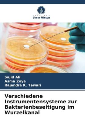 Verschiedene Instrumentensysteme zur Bakterienbeseitigung im Wurzelkanal