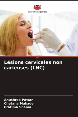 Lésions cervicales non carieuses (LNC)