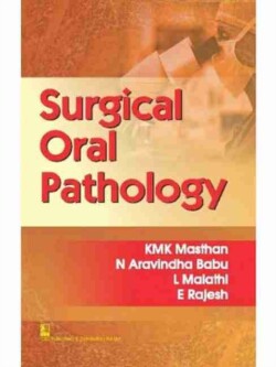 Surgical Oral Pathology
