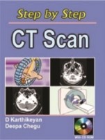 Step by Step CT Scan