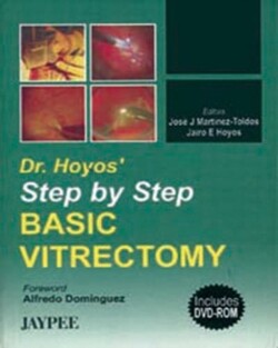 Dr. Hoyos's Step by Step Basic Vitrectomy
