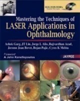 Mastering the Techniques of Laser Applications in Ophthalmology