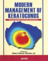 Modern Management of Keratoconus