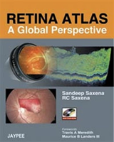Retina Atlas - A Global Perspective