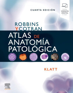 Robbins y Cotran. Atlas de anatomía patológica