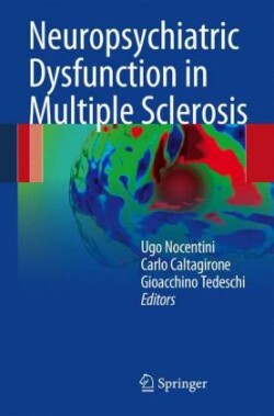 Neuropsychiatric Dysfunction in Multiple Sclerosis
