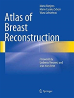 Atlas of Breast Reconstruction