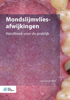 Mondslijmvliesafwijkingen