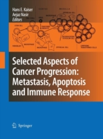 Selected Aspects of Cancer Progression: Metastasis, Apoptosis and Immune Response