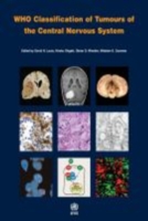 WHO Classification of Tumours of the Central Nervous System