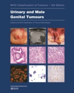 WHO classification of tumours of the urinary system and male genital organs