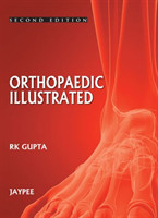 Orthopedics Illustrated