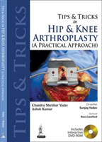 Tips and Tricks in Hip and Knee Arthroplasty