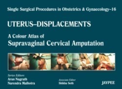 Single Surgical Procedures in Obstetrics and Gynaecology - Volume 16 - UTERUS - DISPLACEMENTS