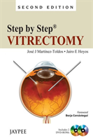 Step by Step: Vitrectomy