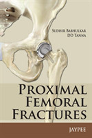 Proximal Femoral Fractures