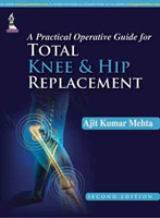 Practical Operative Guide for Total Knee and Hip Replacement