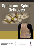 Spine and Spinal Orthosis
