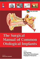 Surgical Manual of Common Otological Implants