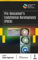 Pre-Descemet’s Endothelial Keratoplasty (PDEK)