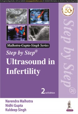 Step by Step Ultrasound in Infertility